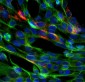 Anti-SARS-CoV-2 S-Protein ACE2 Binding Domain Antibody